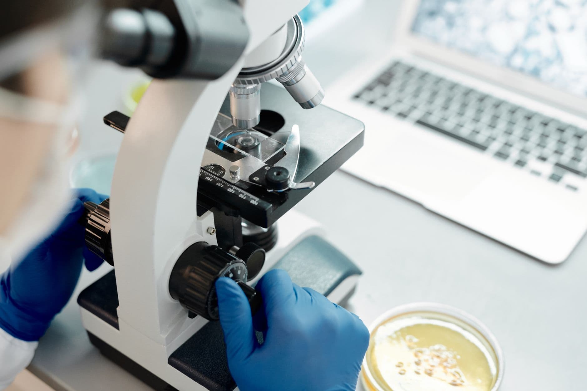 Keto diet may weaken glioblastoma by disrupting cancer cell fuel use