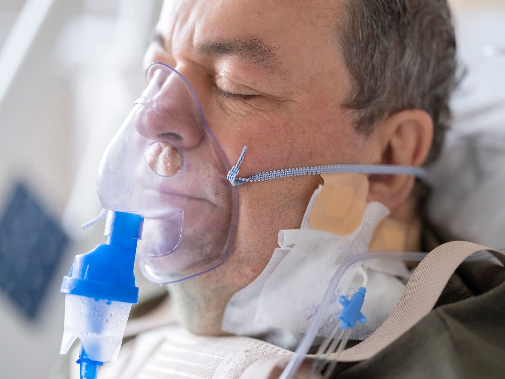 Ketogenic diet shows early promise in intensive care patients