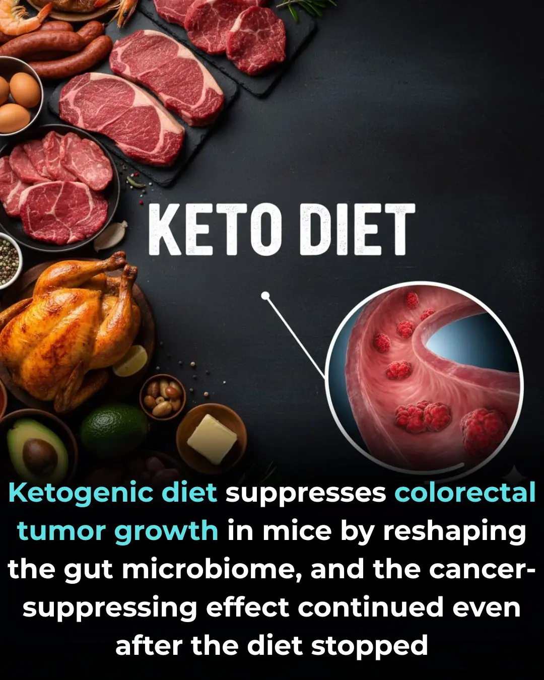 Ketogenic diet may reshape colorectal cancer immunity through gut microbes
