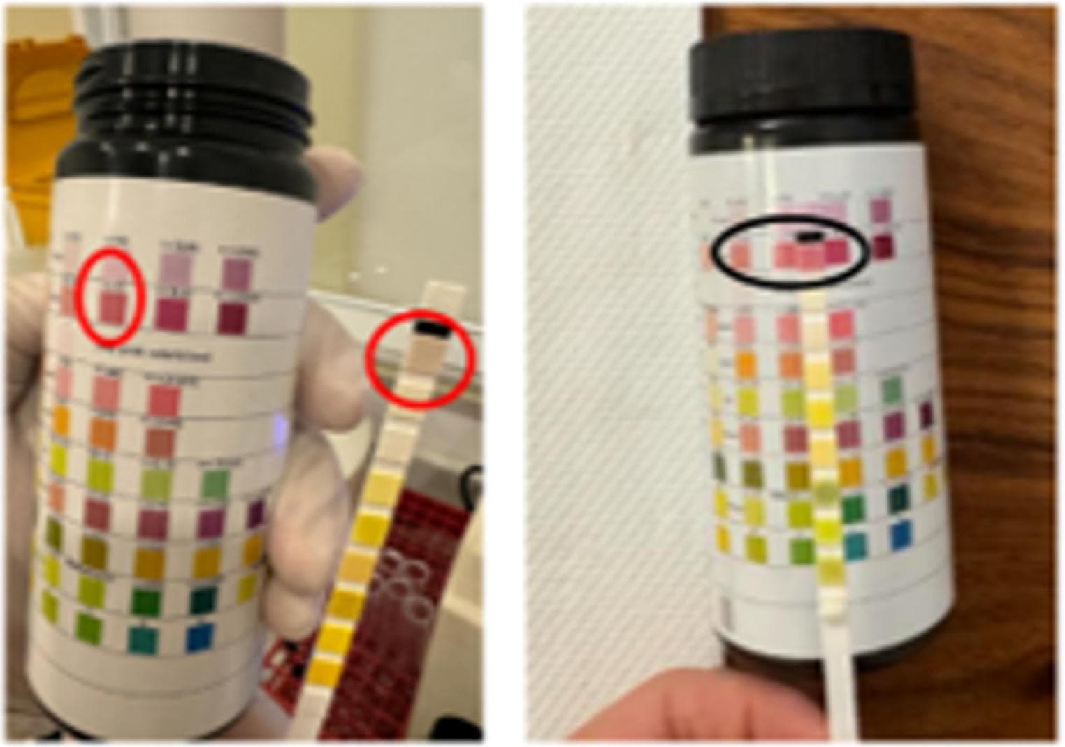 Ketogenic diet matched surgery for weight loss after bariatric relapse