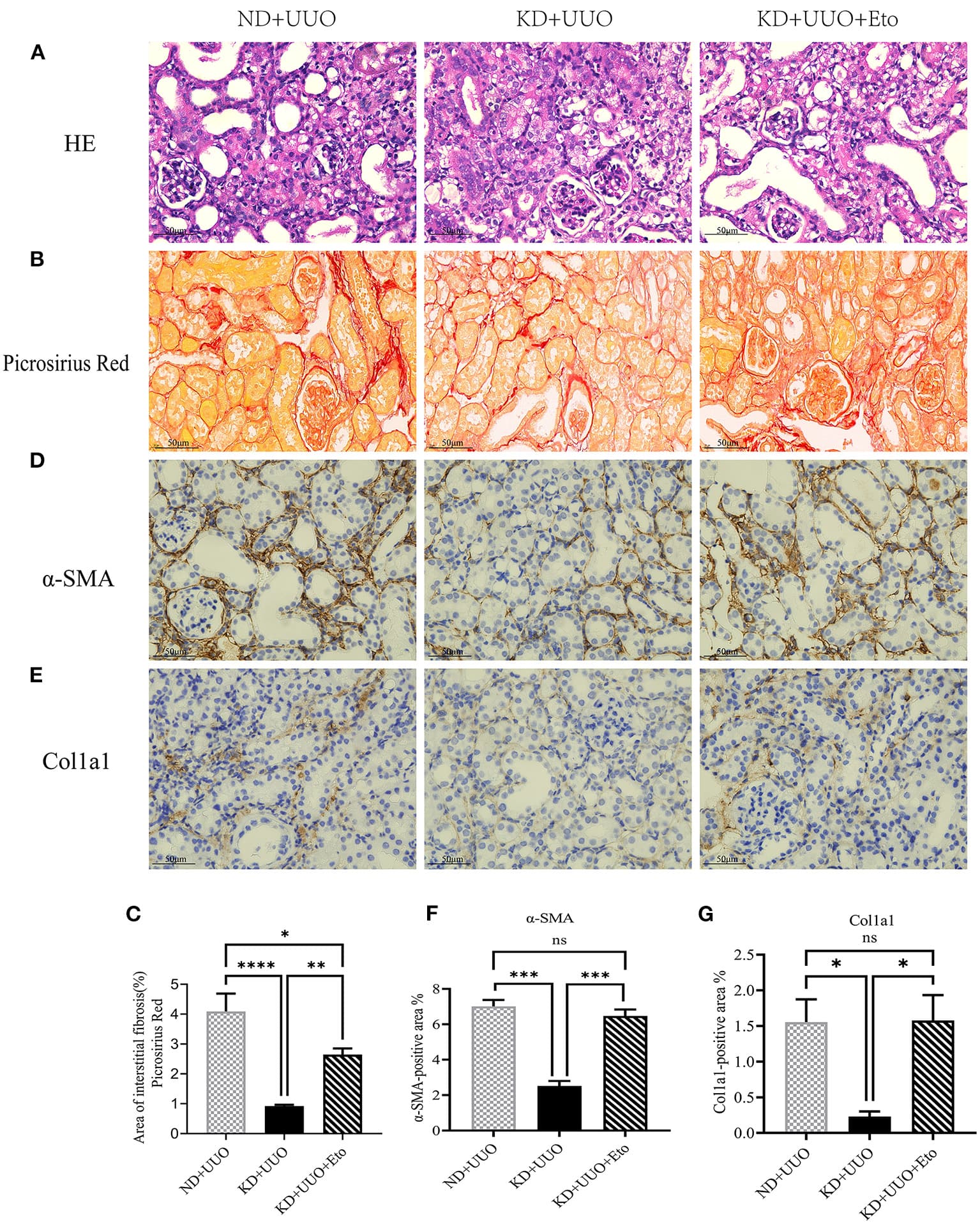 Study finds long-term keto may harm healthy kidneys, but aid injured ones